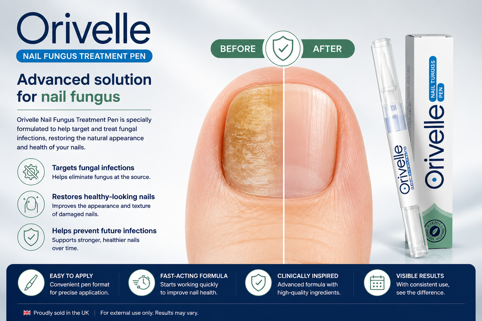 What is Orivelle UK
